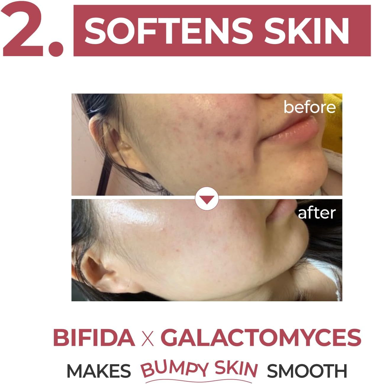 No.3 Serum | Skin Softening Serum | Pores, Textured, Bumpy, Rough to Glass Skin | Bifida, Galactomyces, Niacinamide, Adenosine, Panthenol | 50 Ml