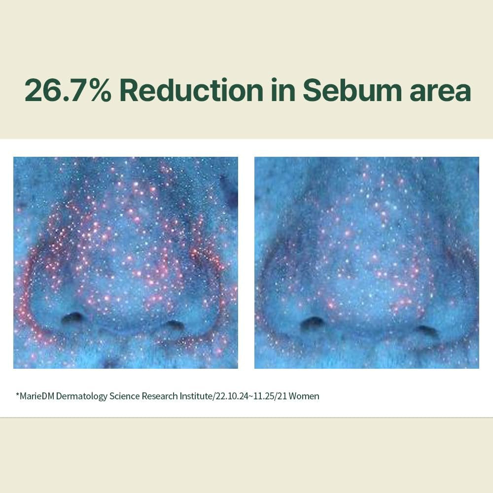 [PKY]  Calming Moisture Serum Instantly Soothes Sensitive Skin, Strenghtens Moisture Barrier with Ceramide, 2 Types of Peptides, Vegan, Korean Skincare. (1.01 Fl.Oz, 30Ml)